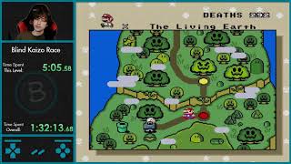 3/3 Yumps FeelsGoodMan - Akogare Mario World part 3