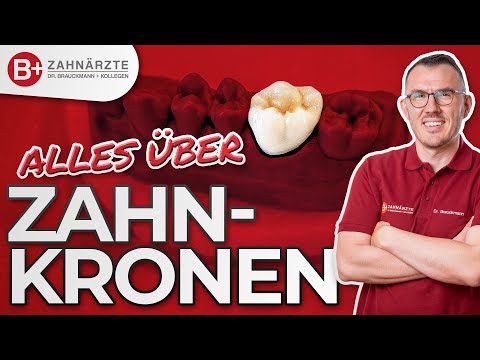 Zahnkronen - Das musst Du VORHER wissen! Alles über die verschiedenen Arten und Materialien!