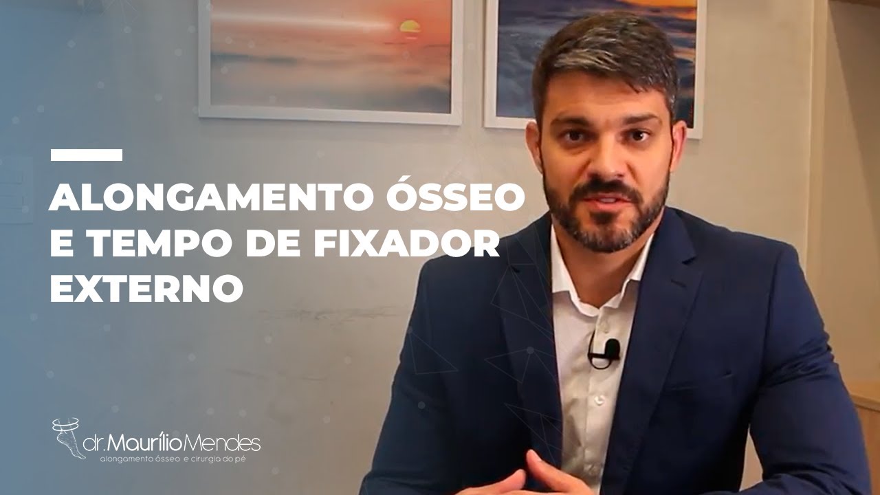 ALONGAMENTO ÓSSEO E TEMPO DE FIXADOR EXTERNO