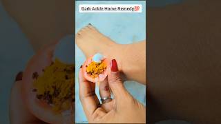 ✅ Dark Ankle Home Remedies|| Feet Cleaning Tips At Home 💯 #shorts #skincare #viral