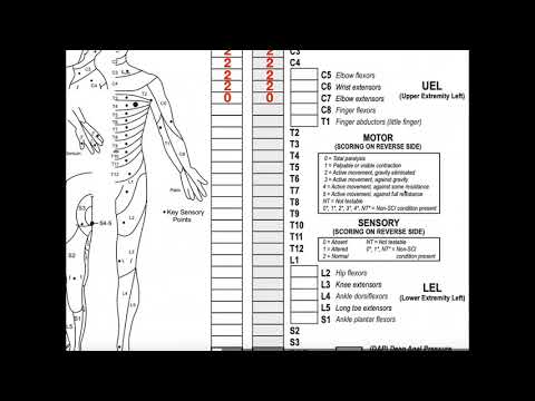Classifying Spinal Cord Injuries using ASIA Scoring [Explanation + Example 1]