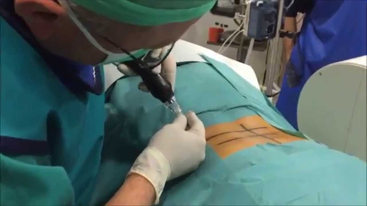 David Alberto Bayona Luna-10