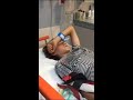 IL S EST CASSÉ LE BRAS