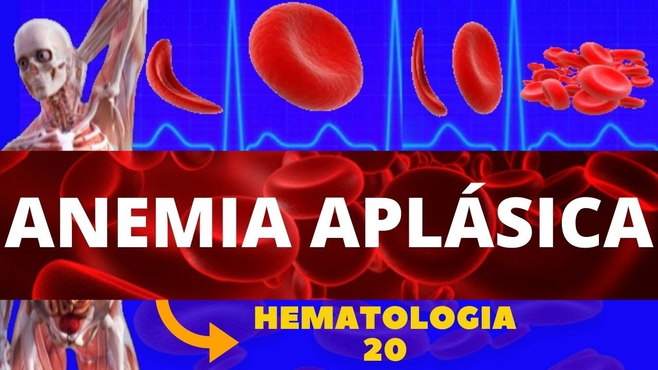 ANEMIA APLÁSICA (ESTUDO DAS ANEMIAS) - HEMATOLOGIA