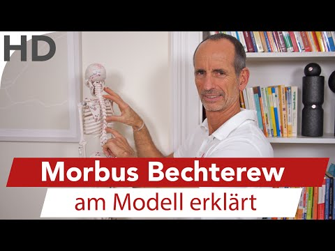 Kann ich eine heiße Dusche mit Nackenschmerzen nehmen Shaparov Gelenke