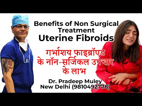 Non-Surgical treatment for Fibroids: Why UFE is a Game-Changer