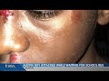12 Year Old Boy Assaulted While Waiting For School Bus