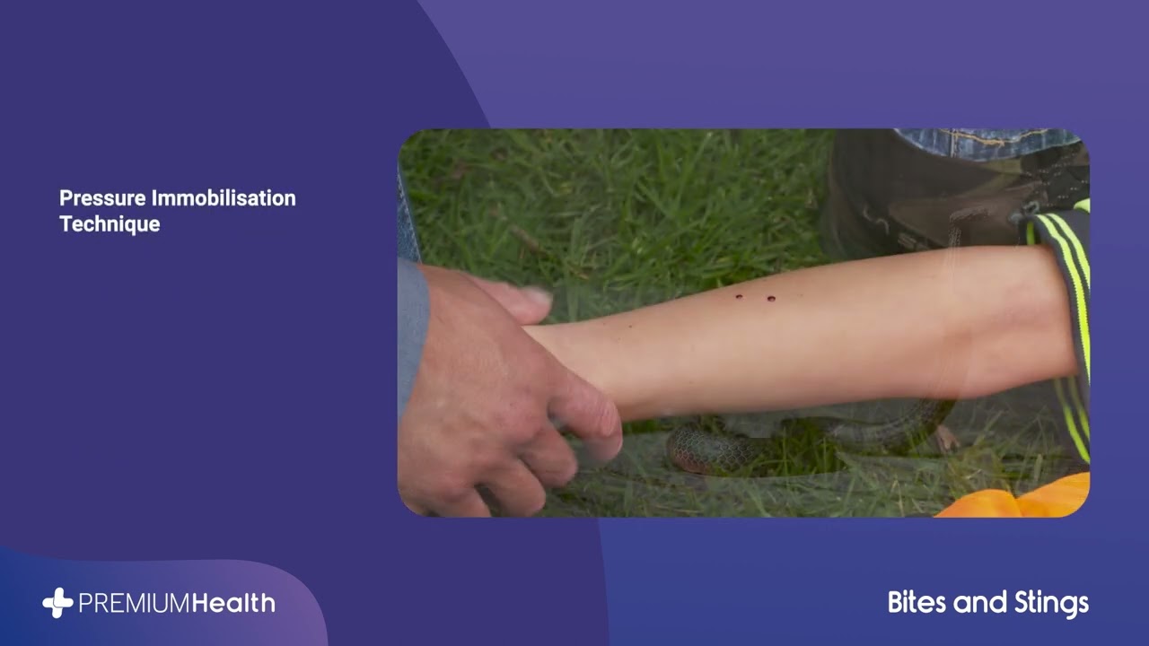 First Aid - Bites & Stings