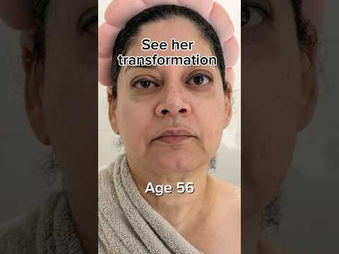 See her transformation | Face Fitness | Face Yoga | Face Massage