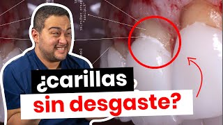 ¿CARILLAS DENTALES SIN DESGASTE ¡PUES NO! ¡CUIDADO con OFERTAS ENGAÑOSAS!