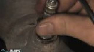 How to Change an Oxygen Sensor