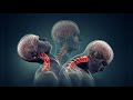 Coup du lapin | whiplash injury [Extrait] | Pierre-Varnum Hammond