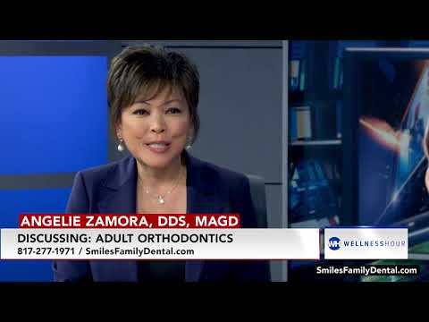 Adult Orthodontics with Dr. Angelie Zamora video thumbnail
