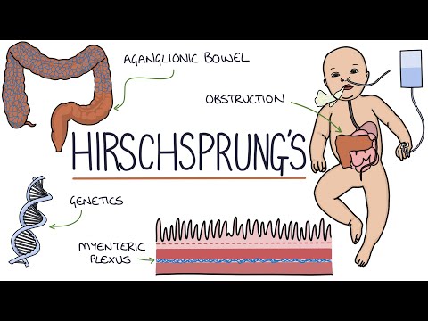 Henoch Schonlein Purpura Visual Explanation for Students
