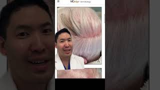 Download lagu Melanoma Warning Sign on your Scalp to Watch Out For! mp3 Download lagu Melanoma Warning Sign on your Scalp to Watch Out For! mp3