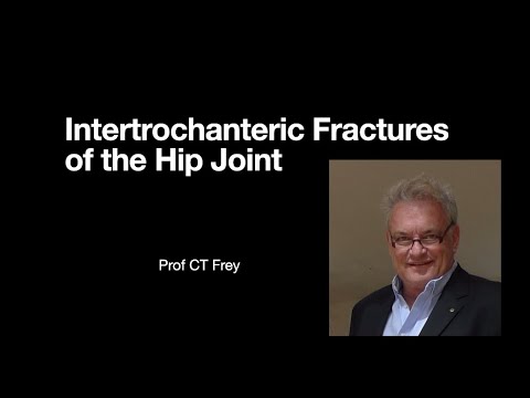 Intertrochanteric Fracture of the Hip