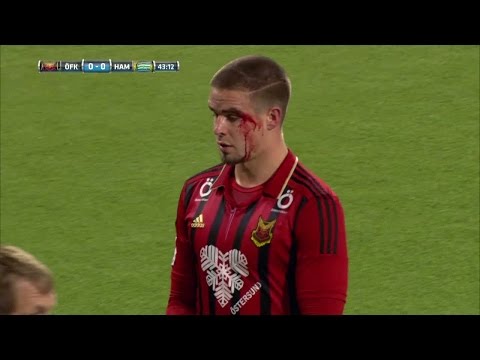 Östersund-spelare blodig efter duell - TV4 Sport