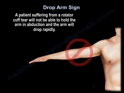 Drop Arm Sign, Rotator Cuff Tear