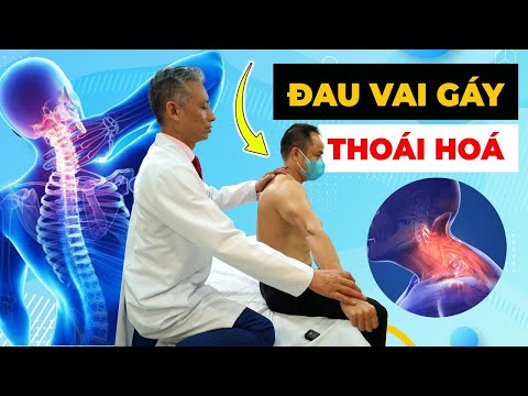 Đau Vai Gáy Do Thoái Hoá? Xem Ngay Để Thoát Khỏi Cơn Đau Này!