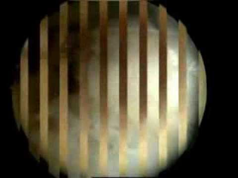 Perché fa male lo stomaco quando si trovano sulla schiena Tira il gomito