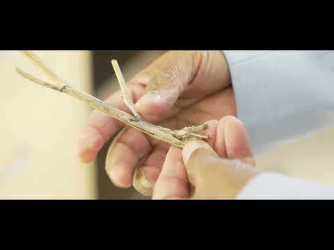 youtube-video-thumbnail