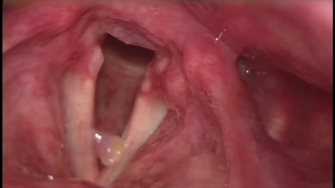 Joaquín Archibaldo Hope Guerrero-12