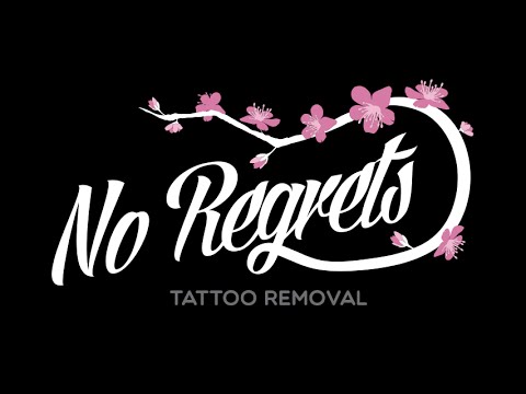 Chest tattoo removal Chinese letters black ink