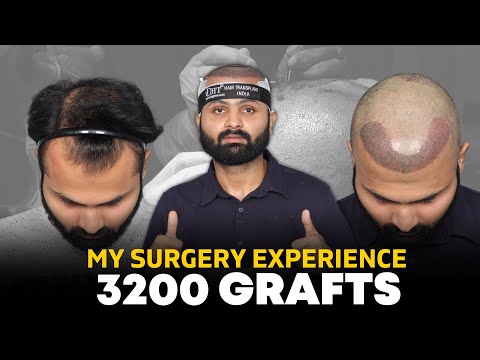 Hair Transplant in Bangalore | Best Results & Cost of...