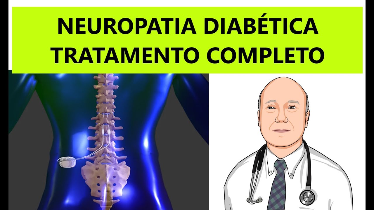 Como tratar neuropatia diabética: tudo que você precisa saber. Os recursos mais modernos.