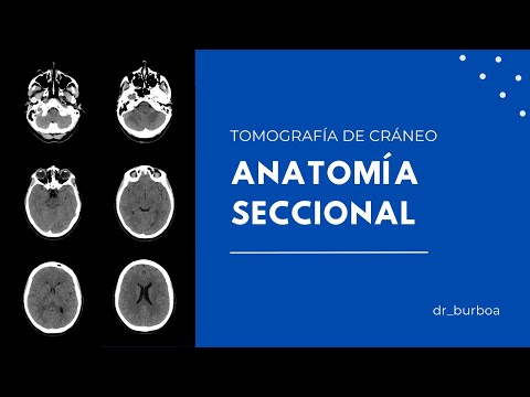 ANATOMÍA SECCIONAL DE CRÁNEO