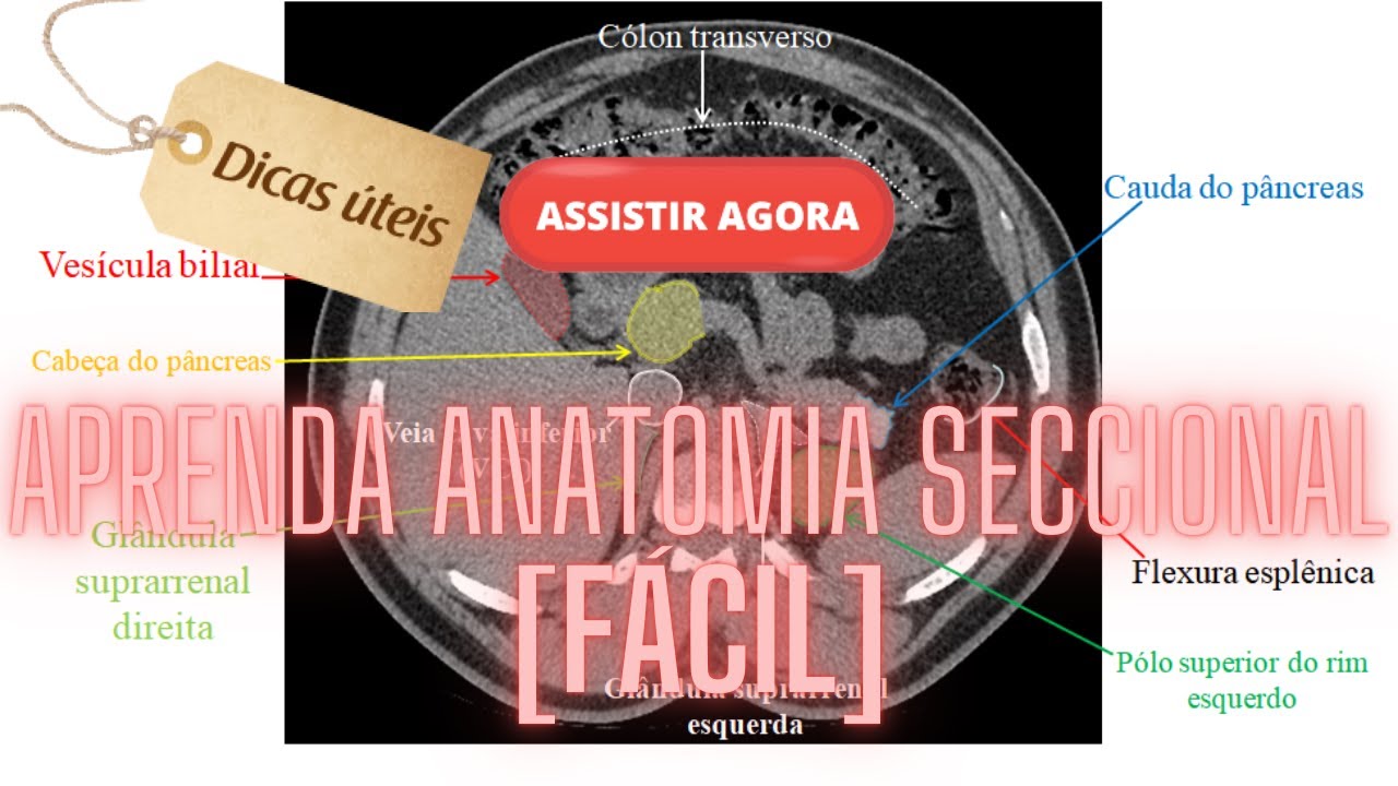 [DICAS] APRENDA ANATOMIA SECCIONAL DO ABDOME POR TOMOGRAFIA