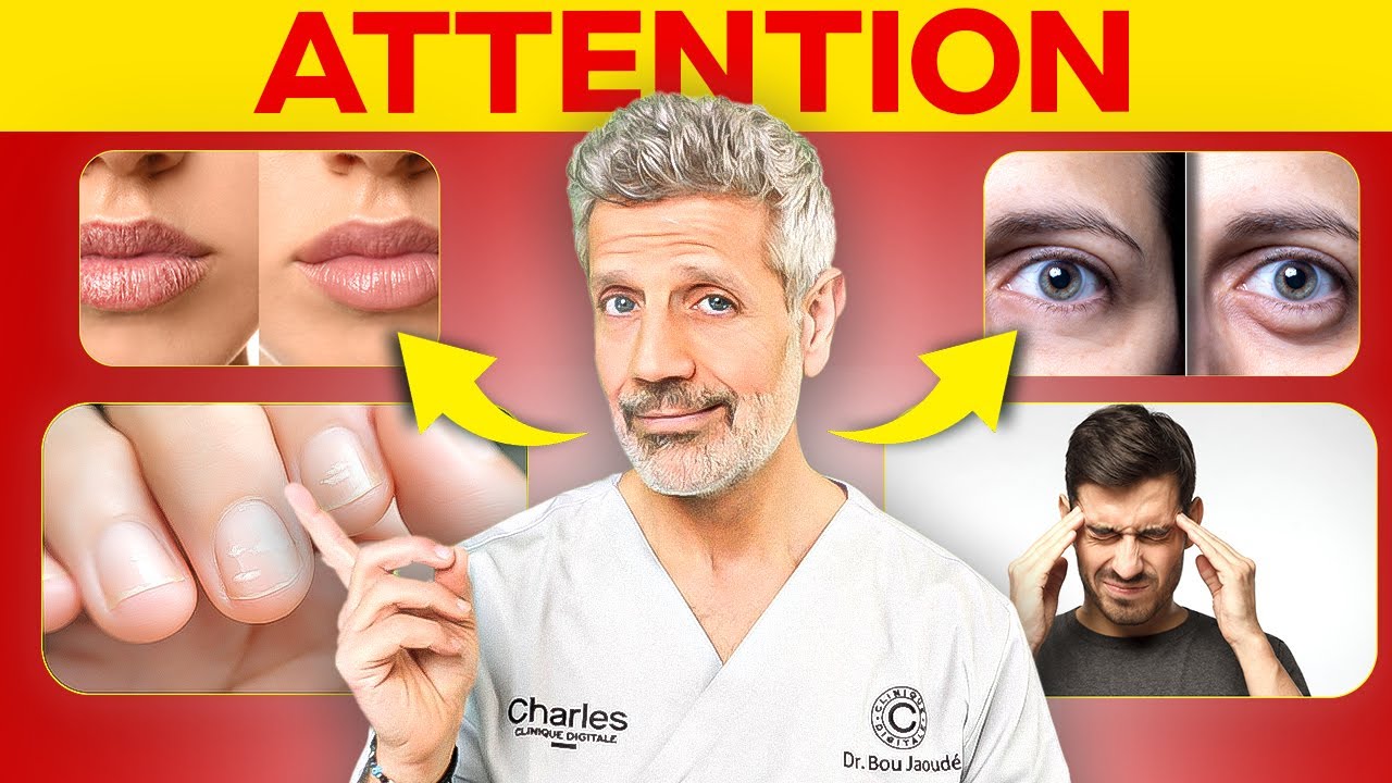 20 Signes que Vous Manquez de Nutriments