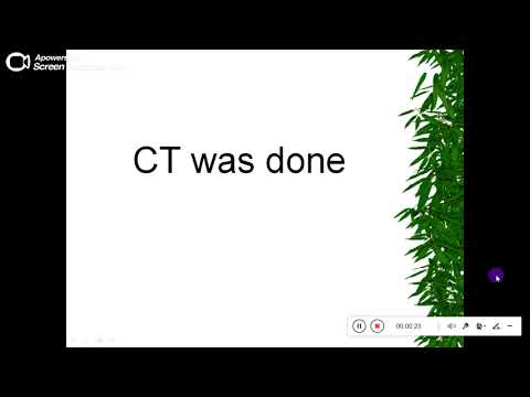 Quiz powerpoint video - Case 192