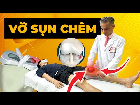 Vỡ Sụn Chêm - Nỗi Ám Ảnh CHẤM DỨT Giấc Mơ VĐV! Còn Cơ Hội NÀO Trở Lại Sân? | Y học Thể thao Starsmec