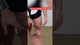 Can You Bruise a Bruise? #shorts #funny #entertainment