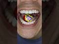 Cadbury Creme Egg ASMR Shorts Asmr DoctorTristanPeh