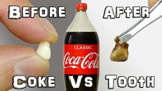 What Does It Do? - Coke Vs Teeth Experiment