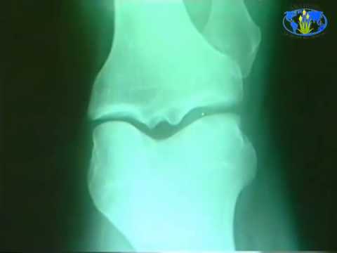 comment soigner arthrose chien