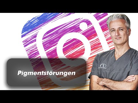 Pigmentstörungen im Gesicht - Hilfe bei Melasma & Chloasma - MeLine Behandlung - Dr. Alamouti Bochum