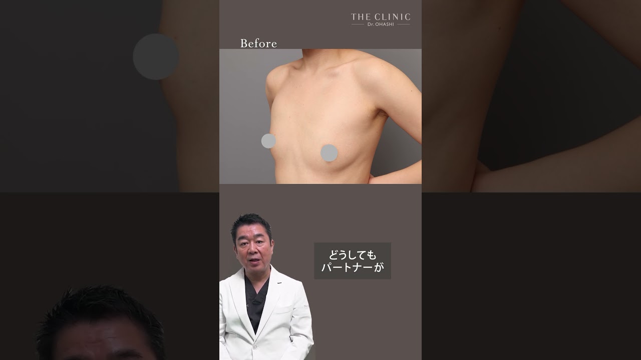 【脂肪豊胸】授乳後のしぼんだバストを復活！