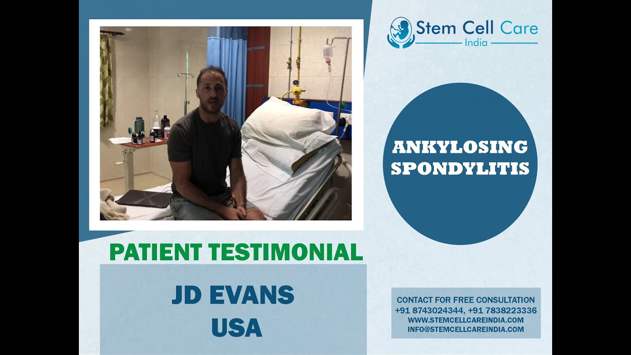 Patient with Ankylosing Spondylitis shares his experience at SCCI| Ankylosing Spondylitis treatment