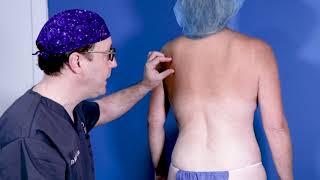 BodyTite Backlift Surgery | Care Plastic Surgery | Cary, North Carolina