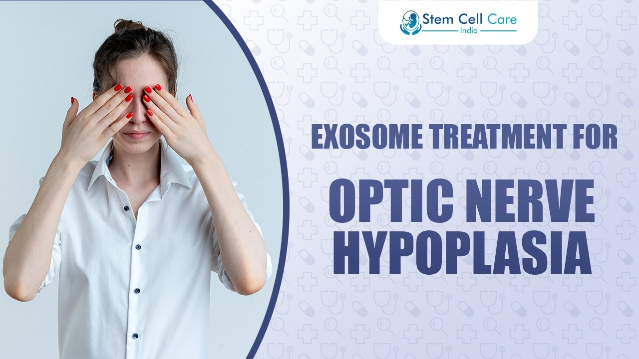 Exosome Treatment for Optic Nerve Hypoplasia | Science & Patient Hope | Eye Regeneration