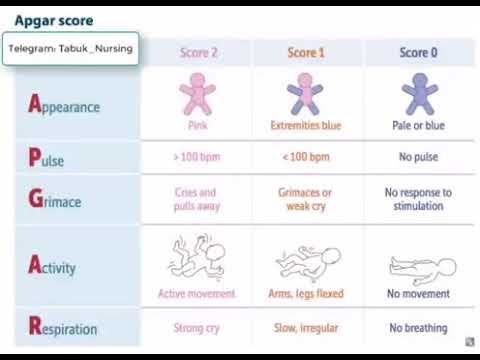 Apgar score