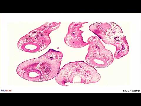 gége topikális papillomatosis típusú condyloma