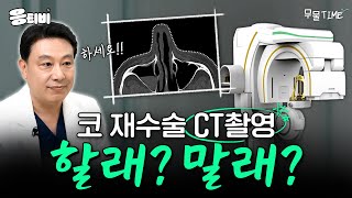 [무.물] 코 재수술 CT촬영 할래❓ 말래❓｜1%성형외과  #김종구 #코수술 #코재수술