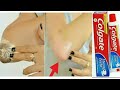 5 मिनट में DARK SKIN से छुटकारा पाएँ|WHITEN DARK ELBOWS & KNEES IN 5 MINUTES|SKIN WHITENING REMEDY