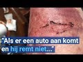 Scootmobiel slaat op hol: bestuurder raakt gewond