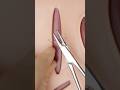 How Many Stitches Suturing Funfacts Surgeonlife Vet Medicine Surgery Stitches Goodtoknow