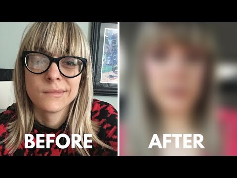 download lagu mp3 mp4 Ramsay Hunt, download mp3 Ramsay Hunt free download mp3, download mp3 Ramsay Hunt